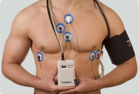 Traditional holter monitor
